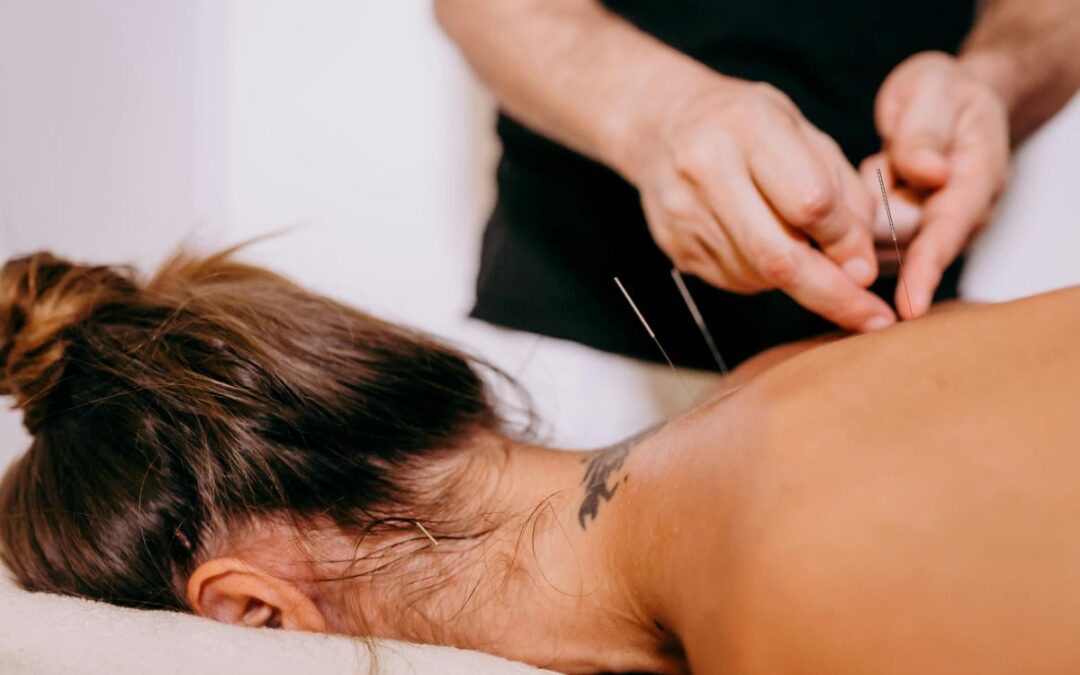 Acupuncture for Fertility Health in Parksville
